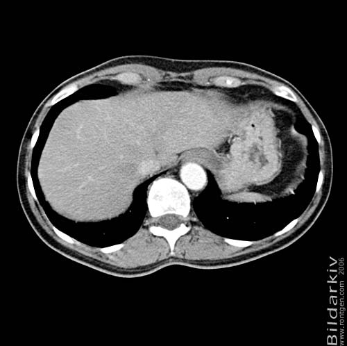 Thorax 50