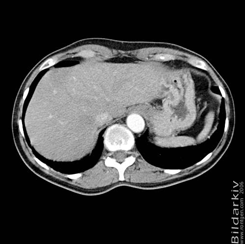Thorax 51