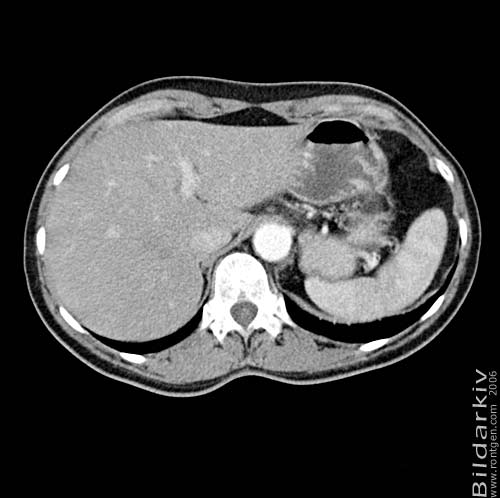 Thorax 54